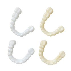 Snap On Smile, Snap on Veneers