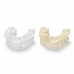 Snap On Smile, Snap on Veneers