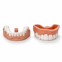 Snap On Smile, Snap on Veneers