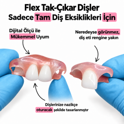 Flexible Partial Denture ROCHE Bridge