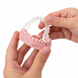 Snap On Smile, Snap on Veneers